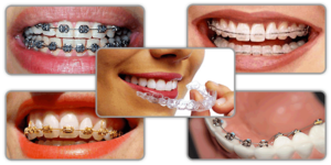 orthodontics san antonio