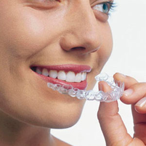 orthodontic treatment