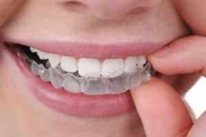 orthodontic treatment with Invisalign braces