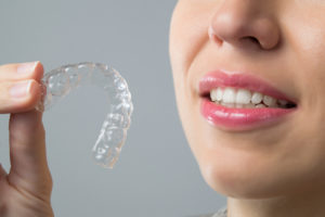 orthodontic treatment - invisalign
