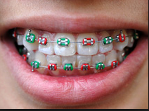 Orthodontics san antonio